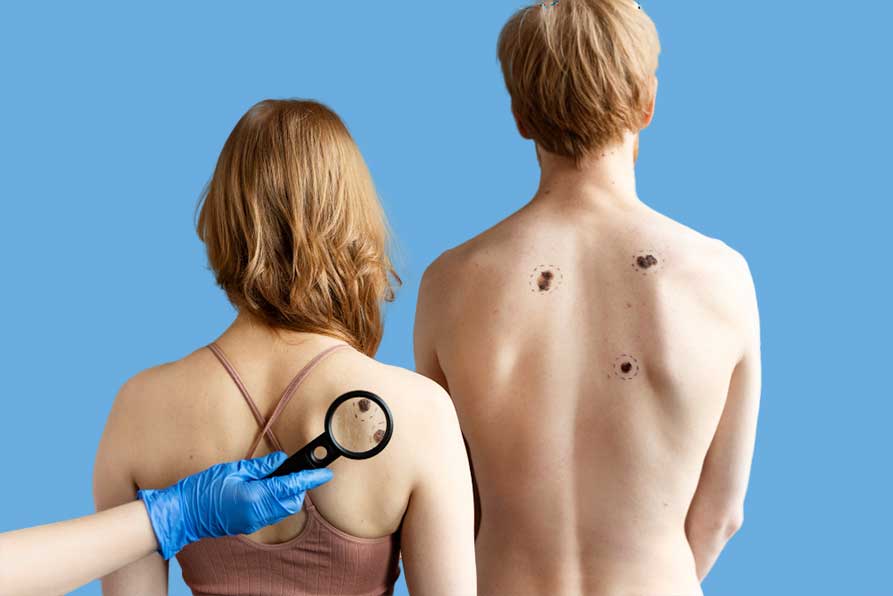 Test y Tratamiento Virus del Papiloma Humano